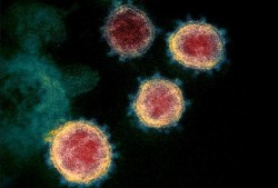 比利时爆料新冠病毒视频,揭秘新冠病毒起源之谜